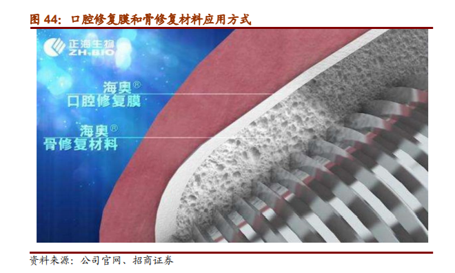 口腔种植牙行业深度报告——招商证券